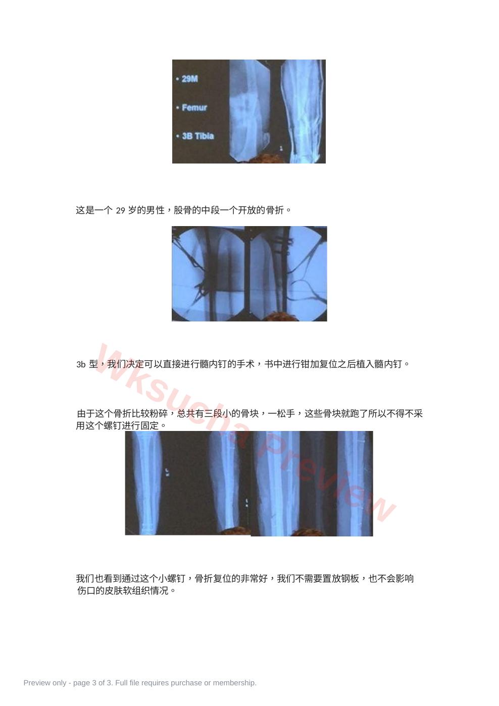 预览第 3 页