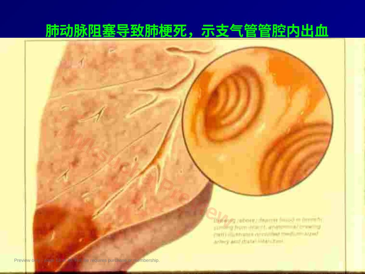 预览第 12 页
