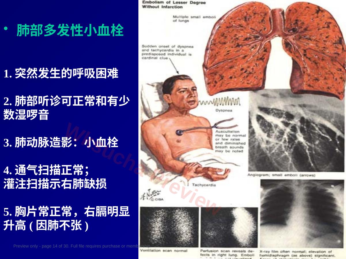预览第 14 页