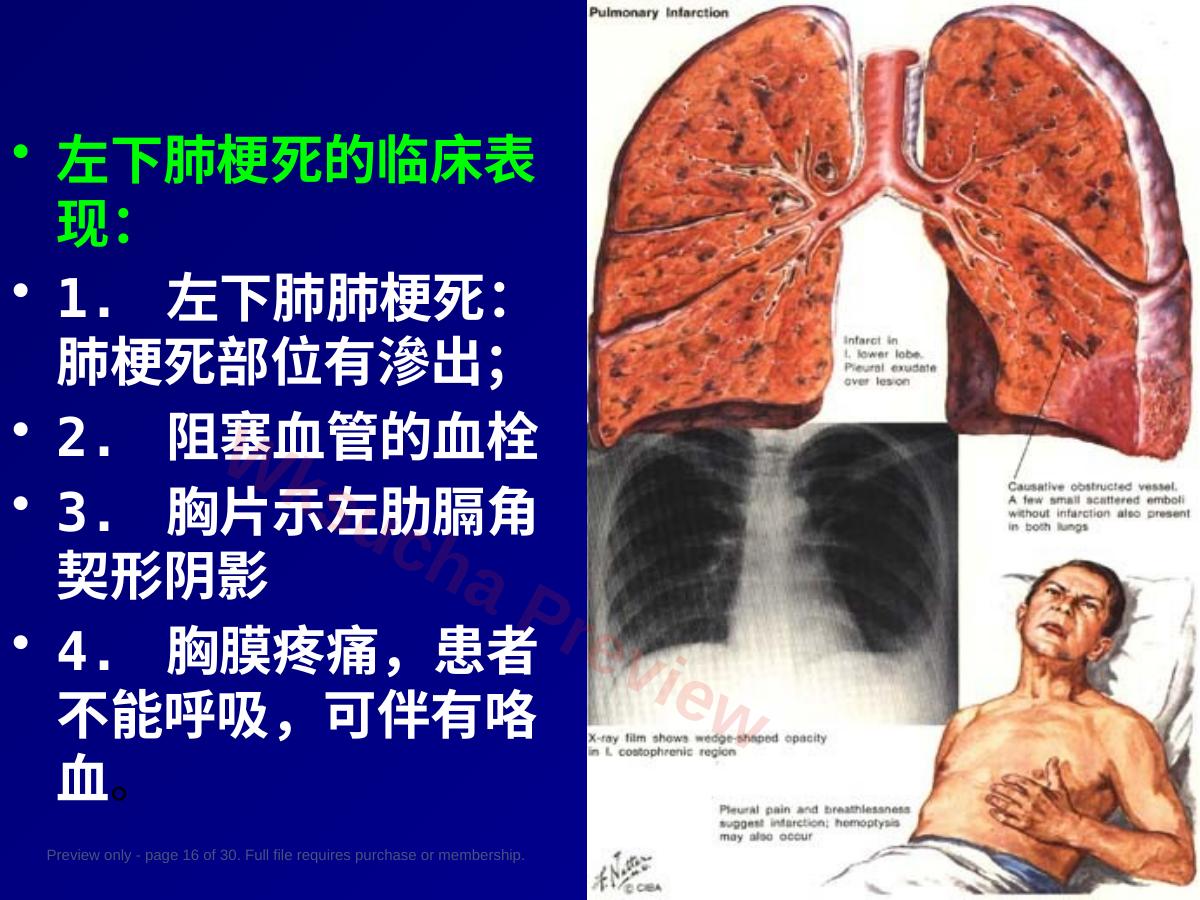 预览第 16 页