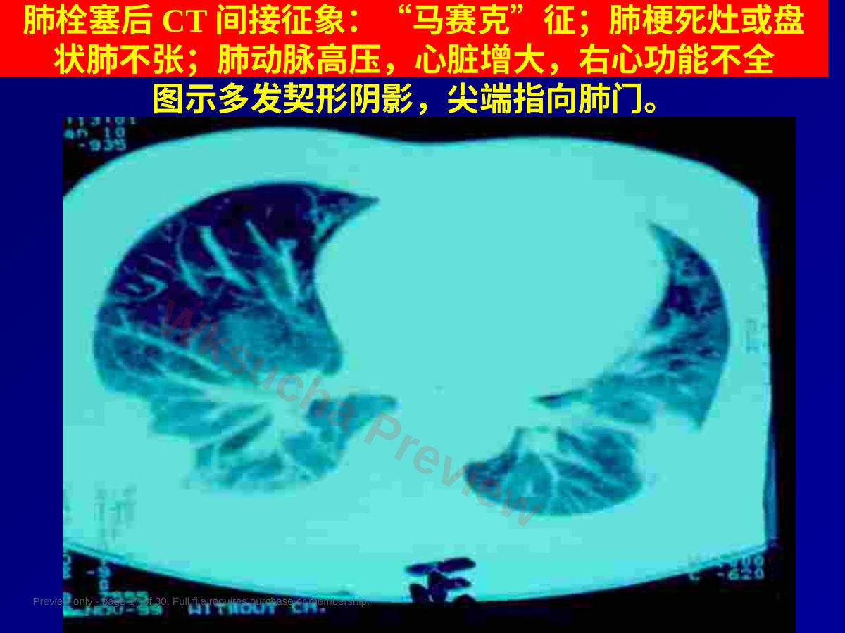 预览第 17 页