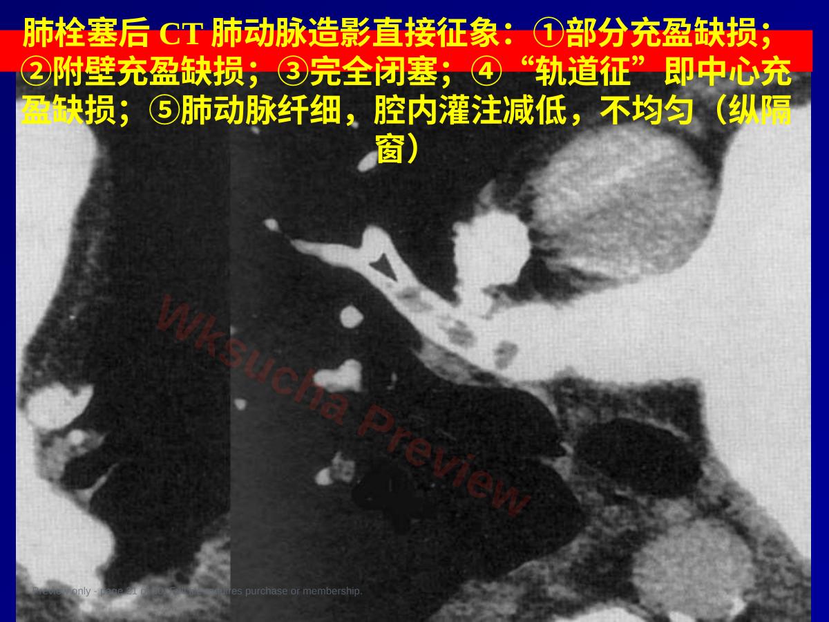 预览第 21 页
