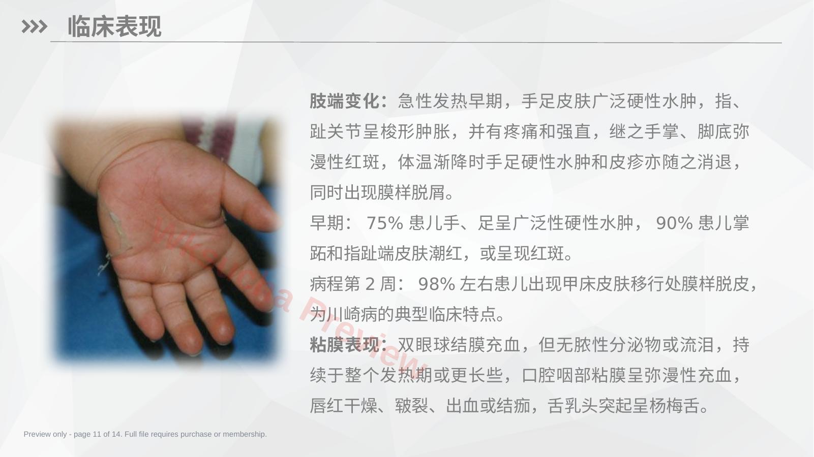 预览第 11 页