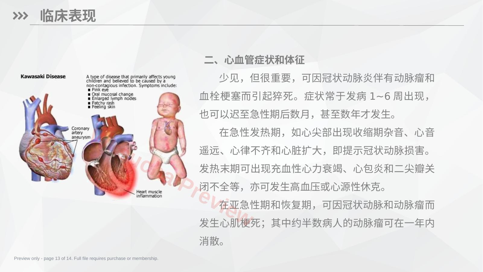 预览第 13 页