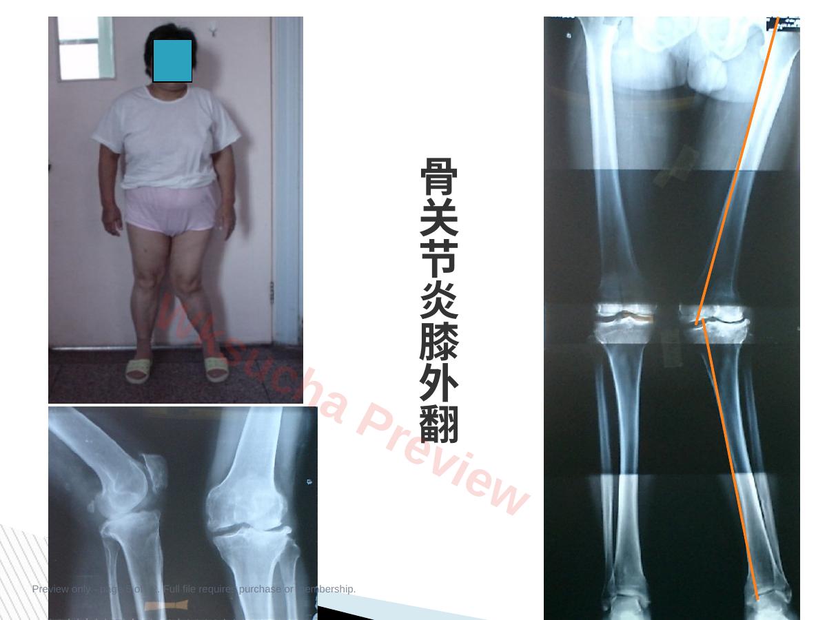 预览第 5 页