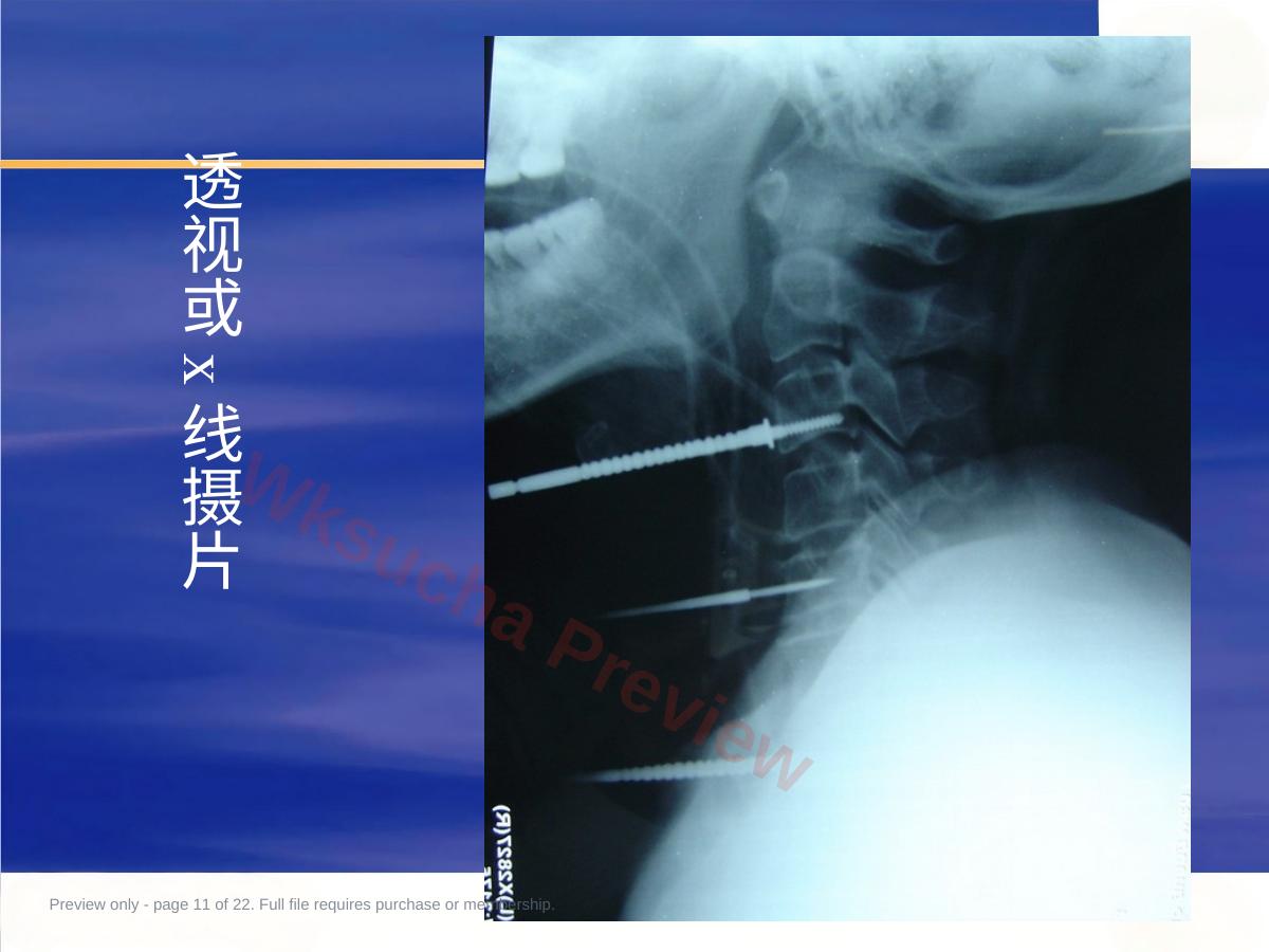 预览第 11 页
