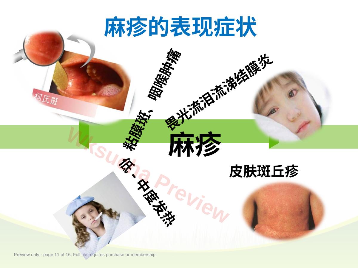 预览第 11 页