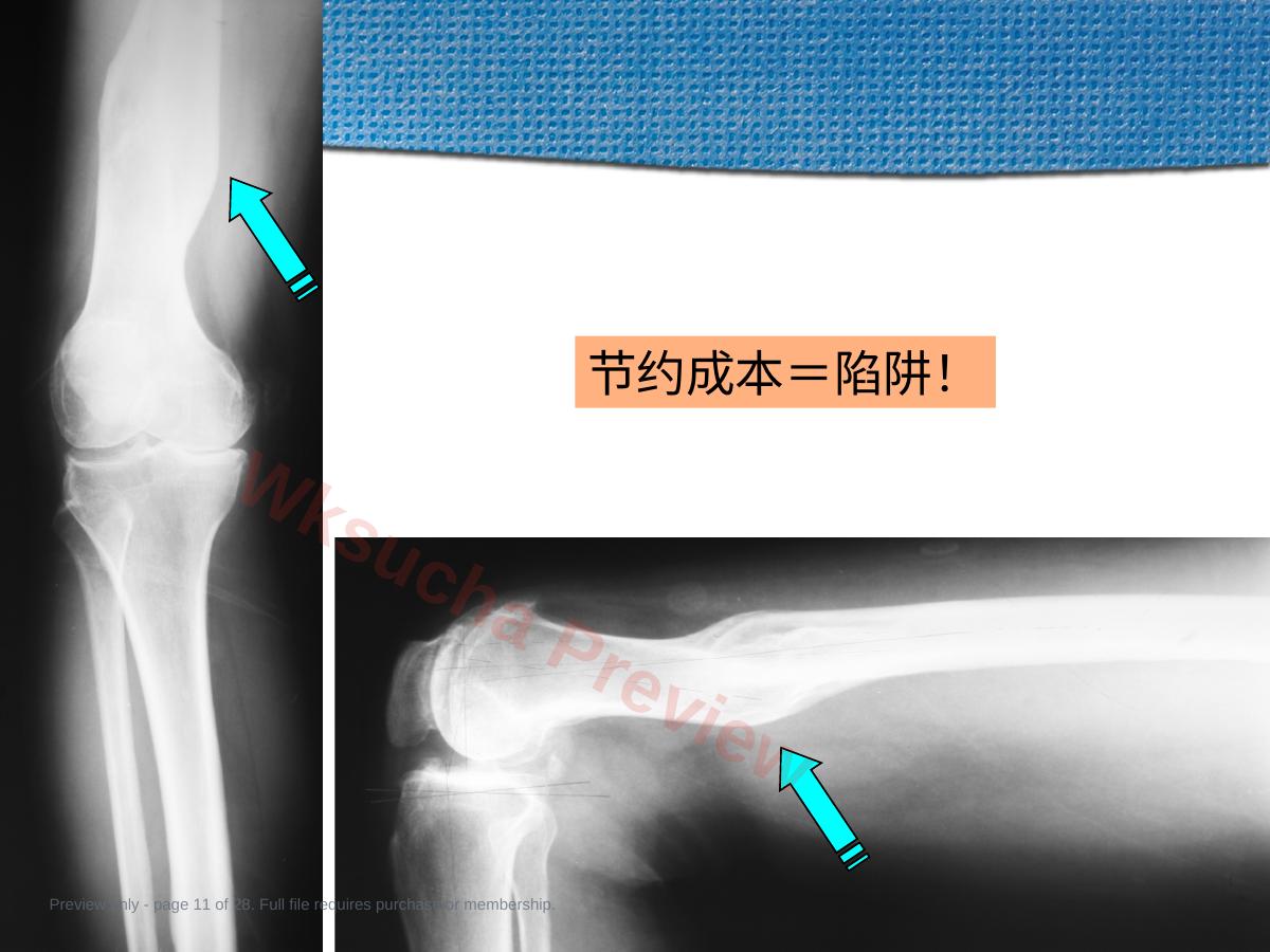 预览第 11 页