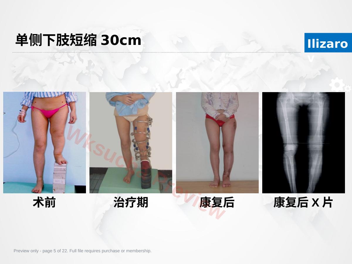 预览第 5 页