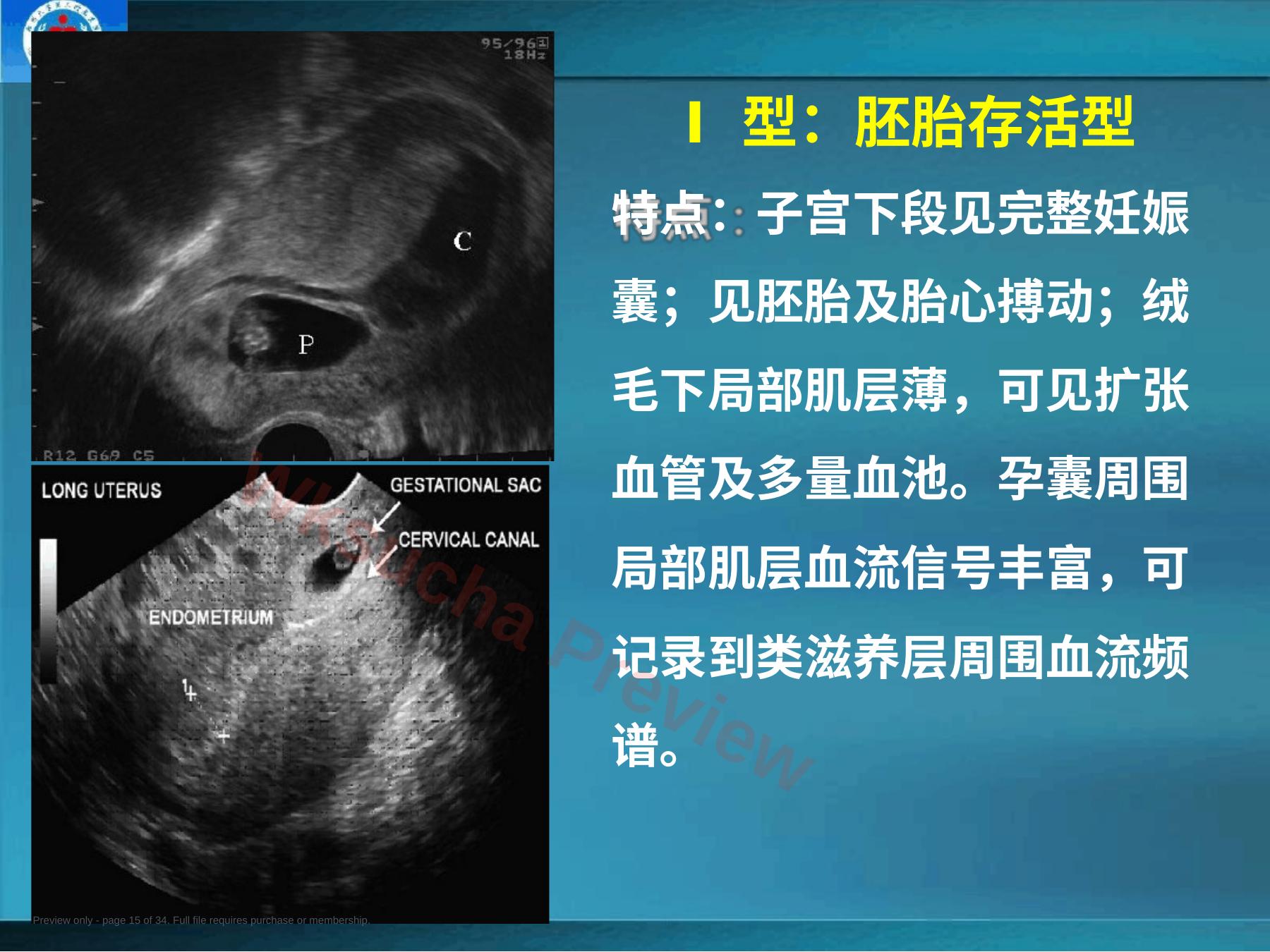 预览第 15 页
