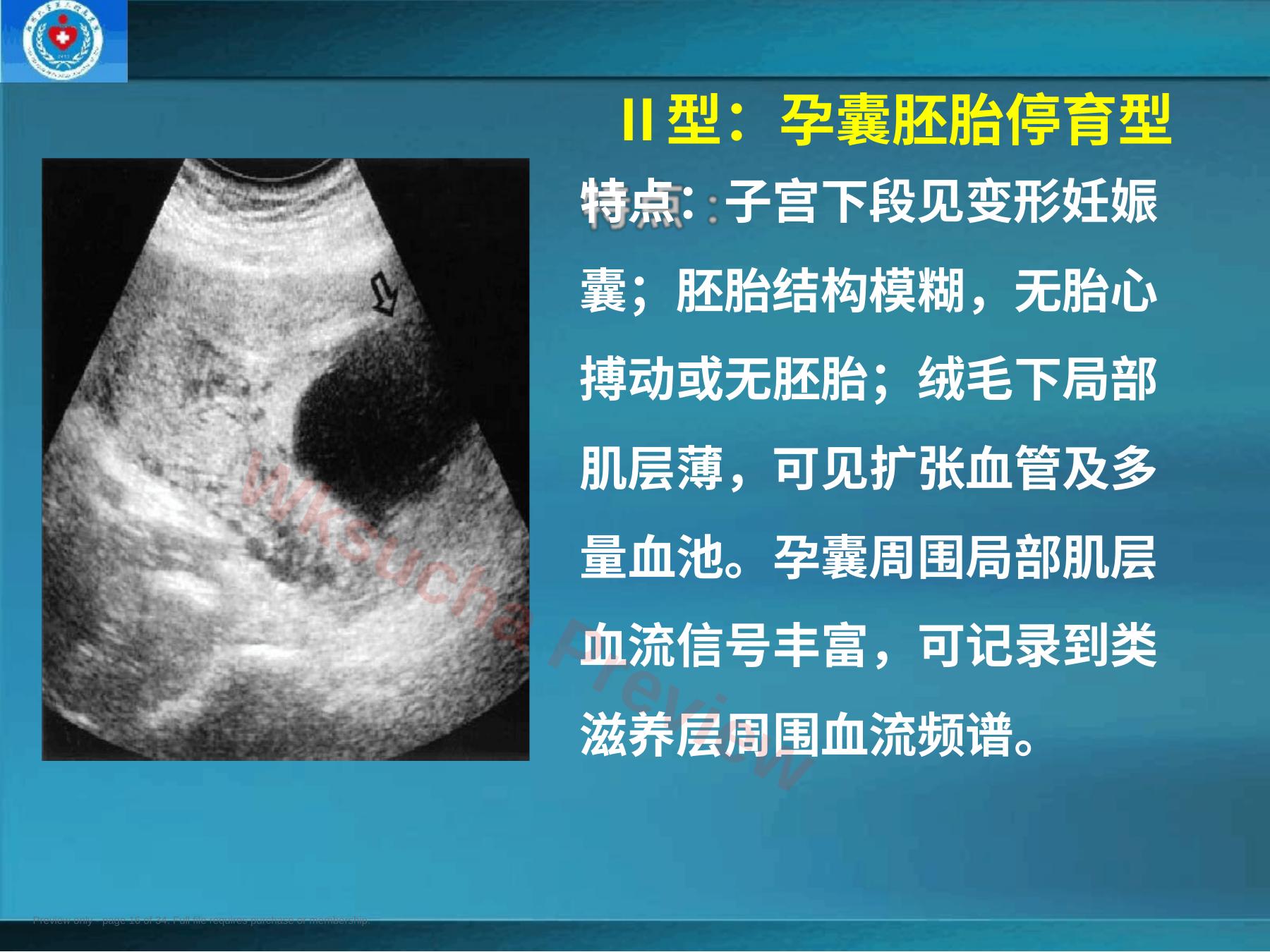 预览第 16 页