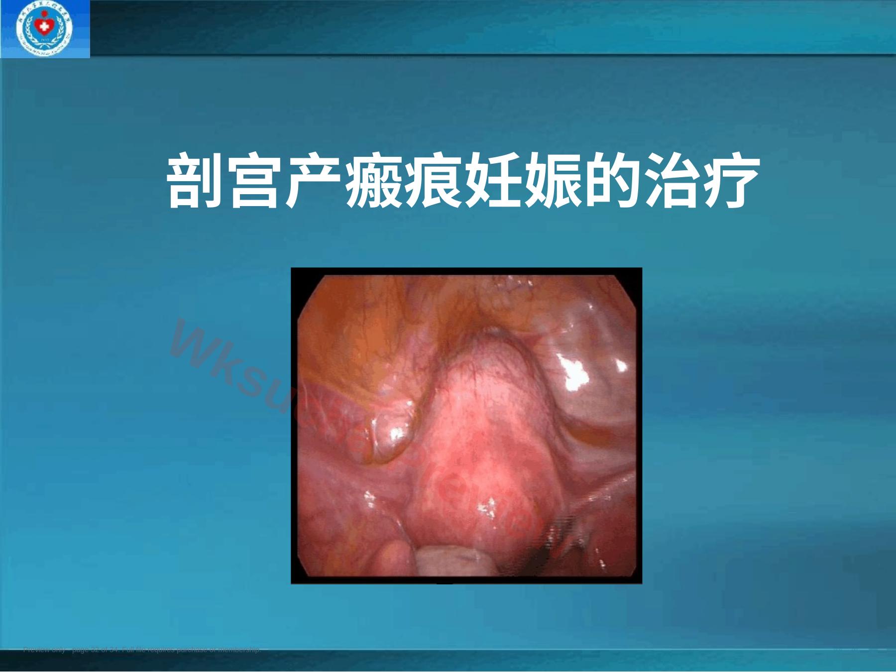 预览第 32 页