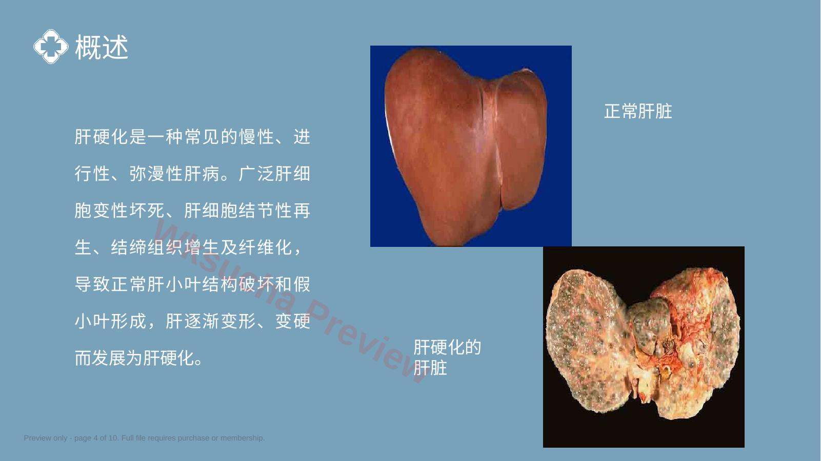 预览第 4 页