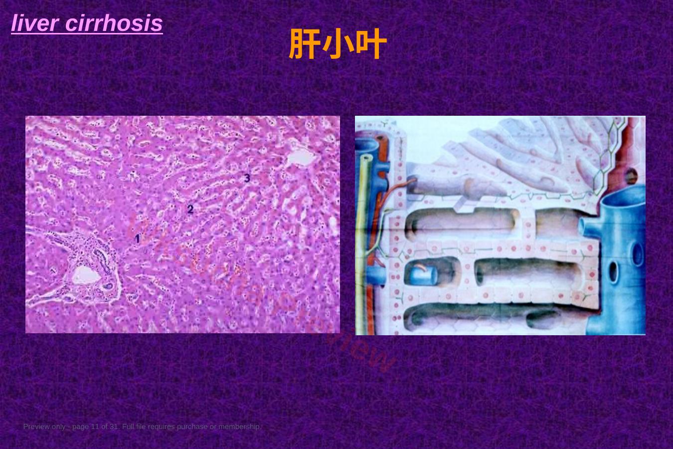 预览第 11 页