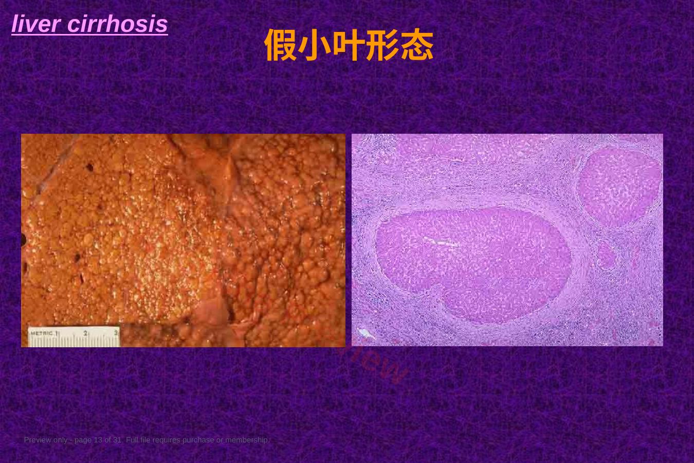 预览第 13 页