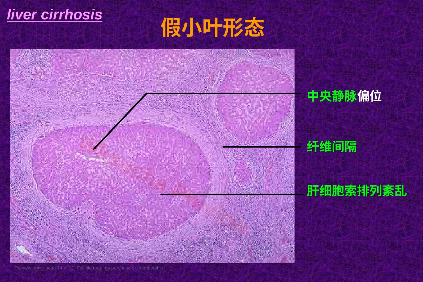 预览第 14 页