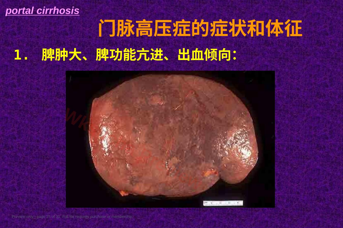 预览第 25 页