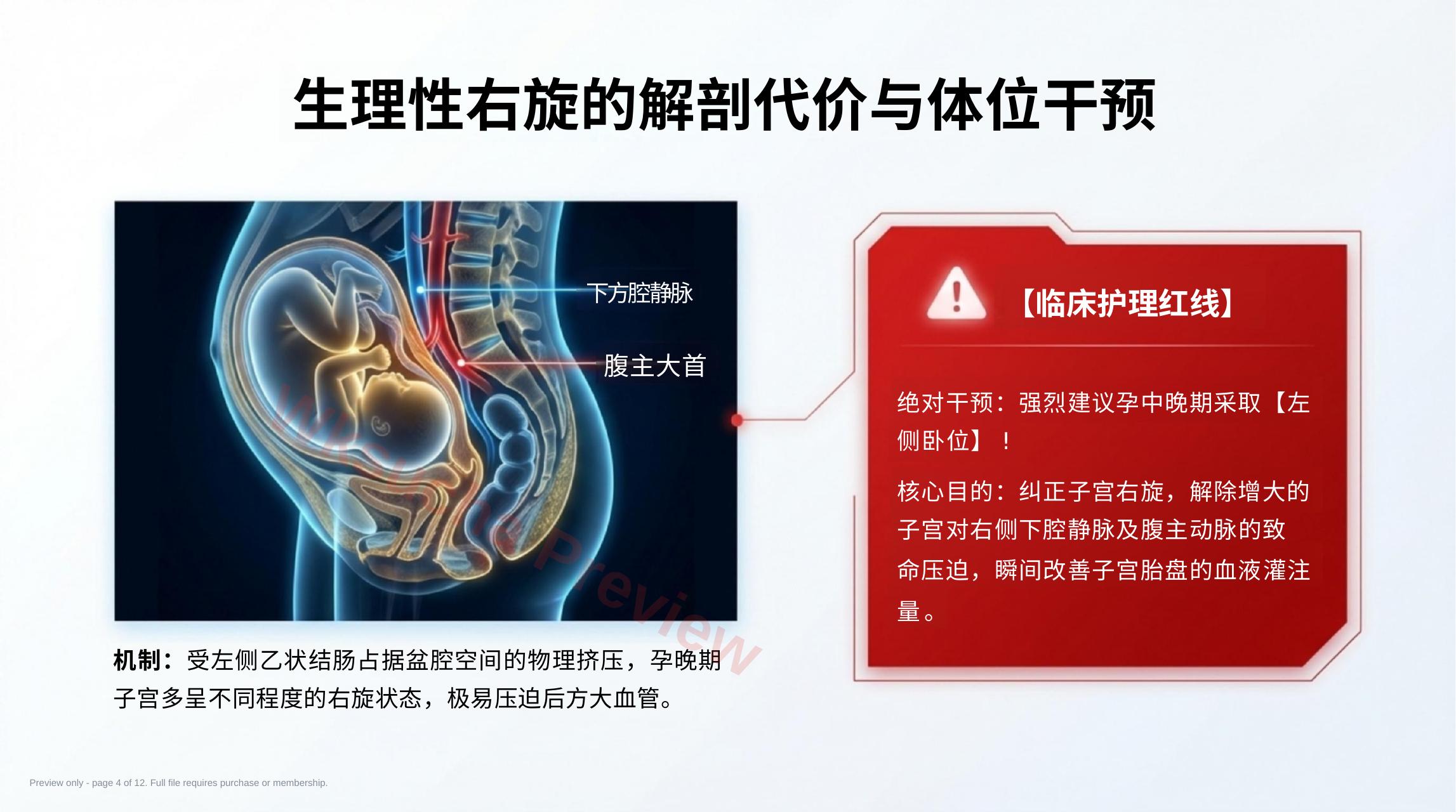 预览第 4 页