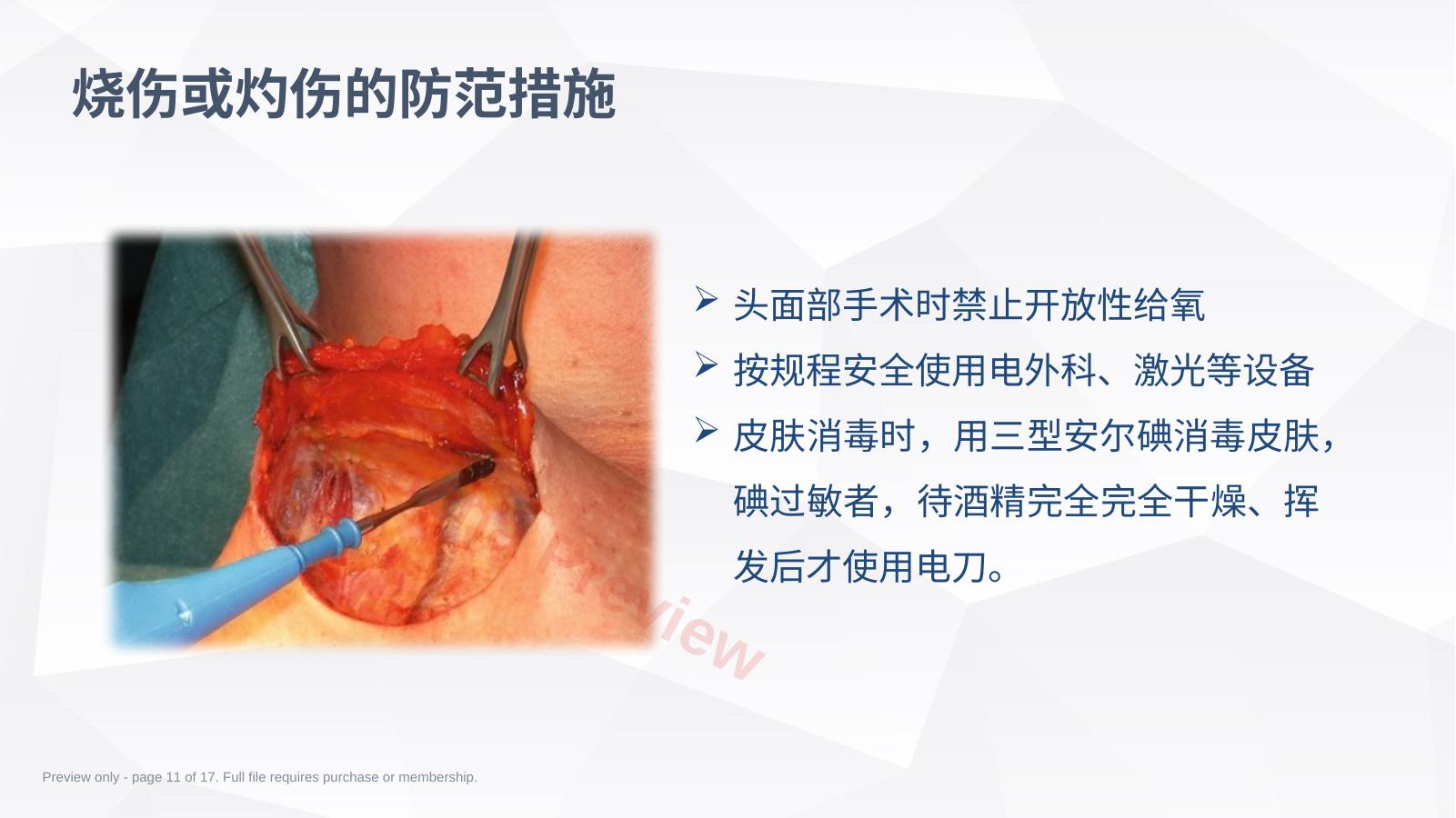 预览第 11 页
