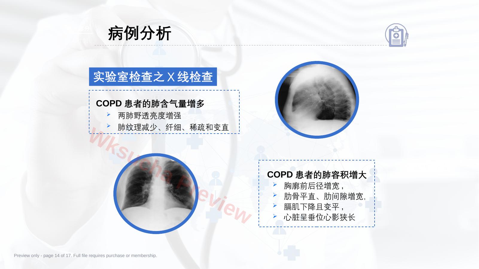 预览第 14 页