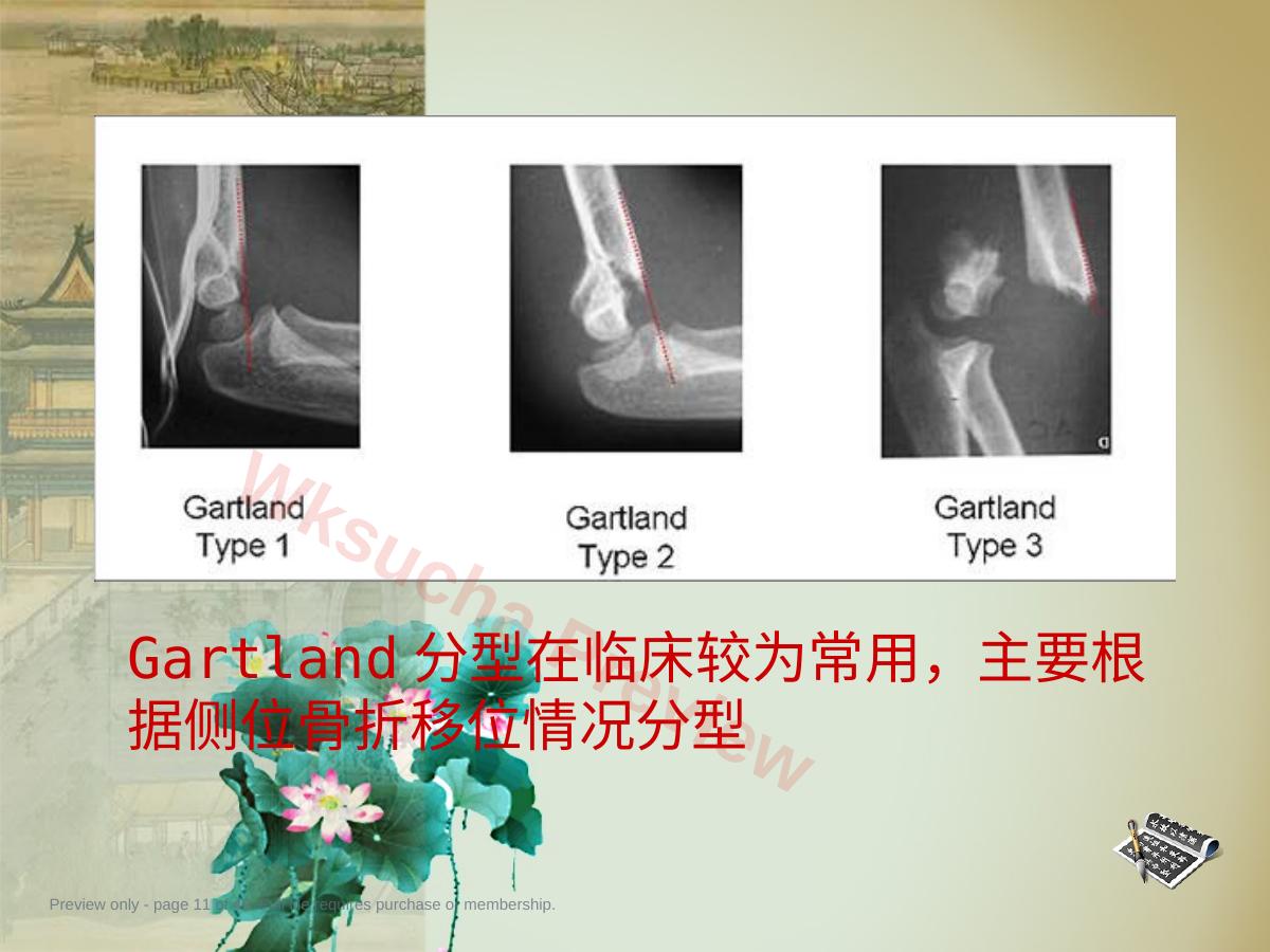 预览第 11 页
