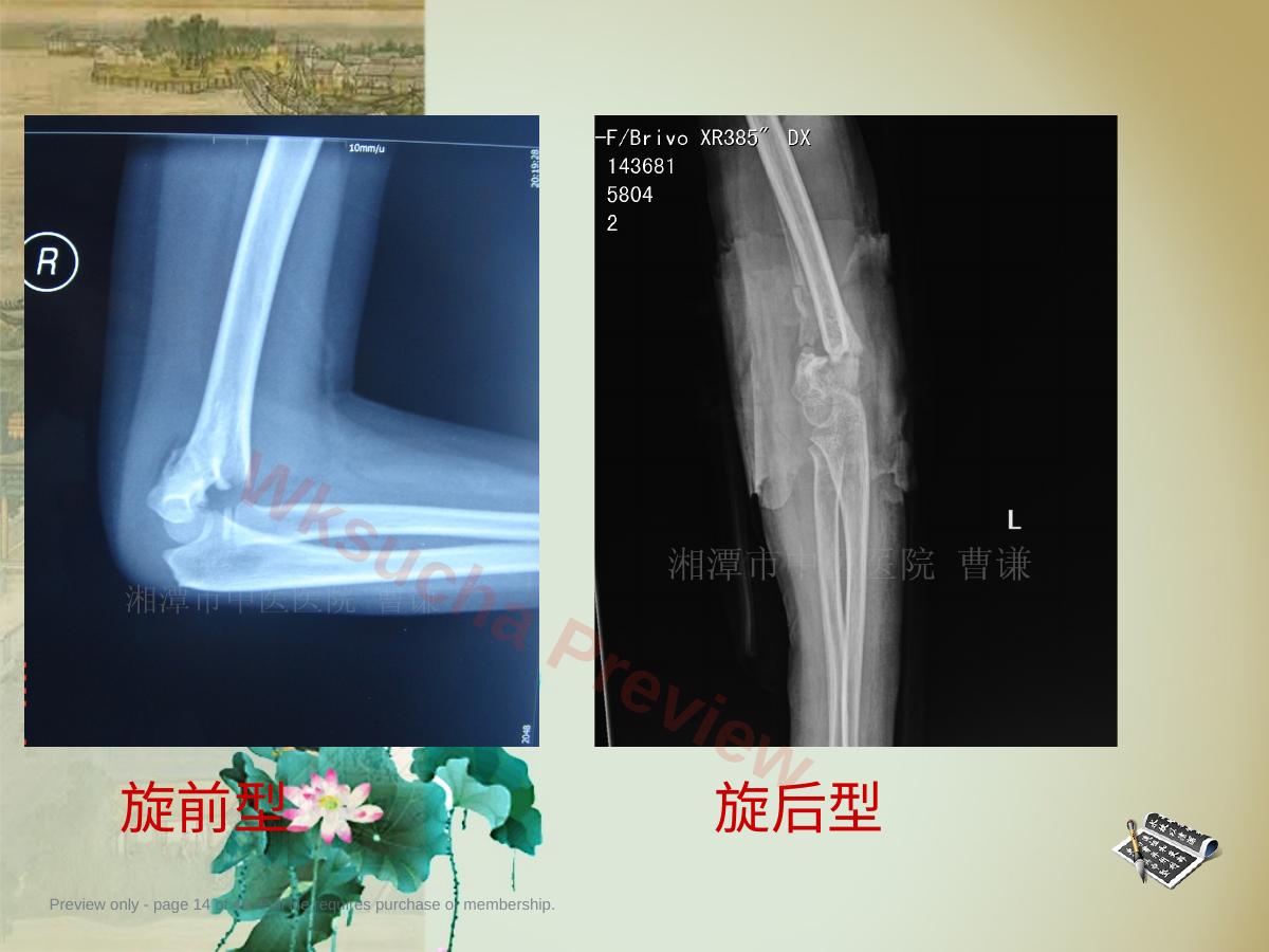 预览第 14 页