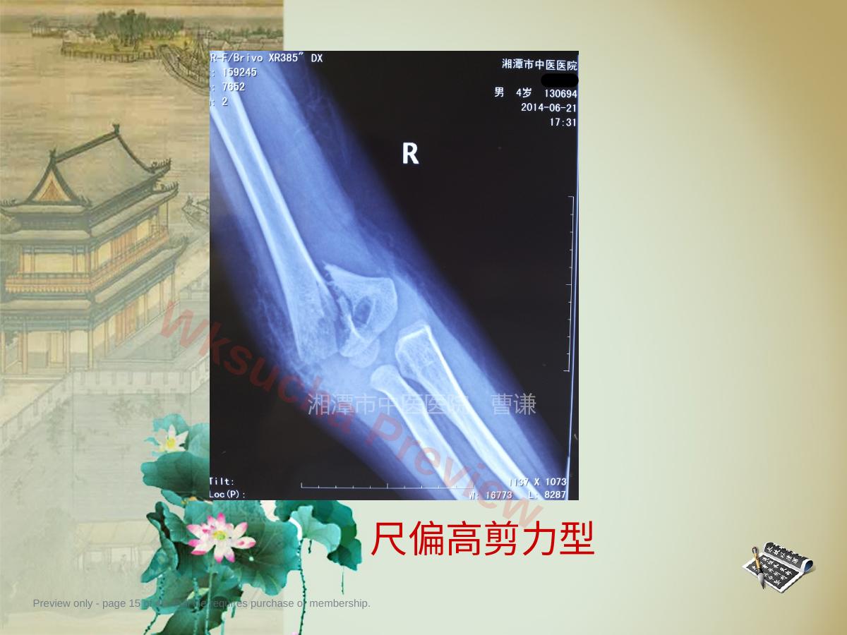 预览第 15 页