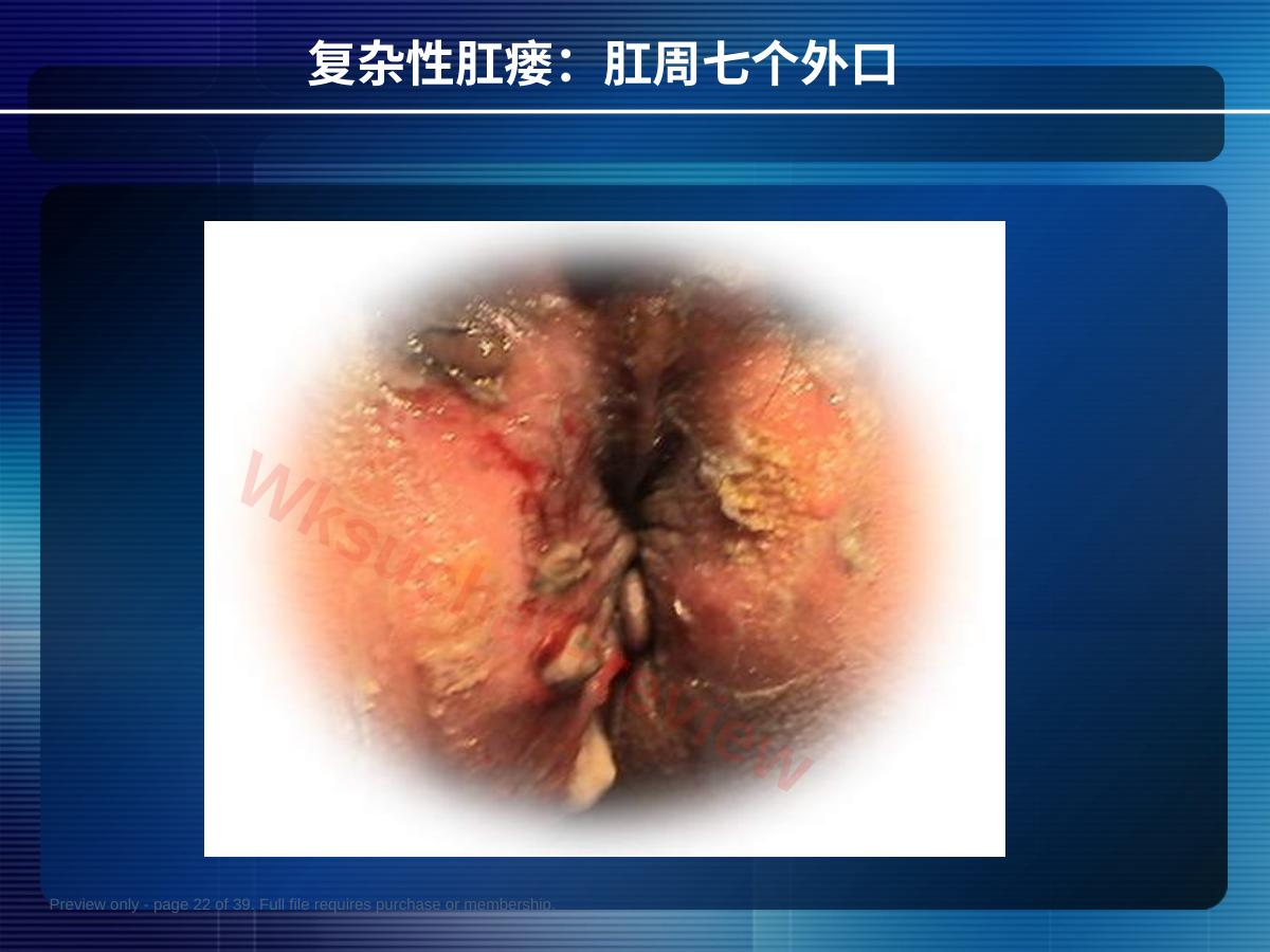 预览第 22 页
