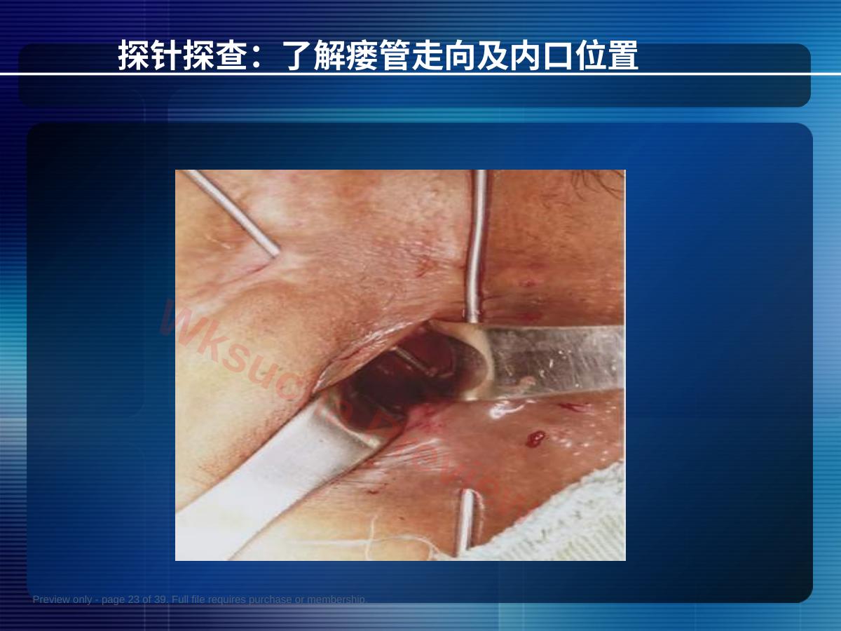 预览第 23 页