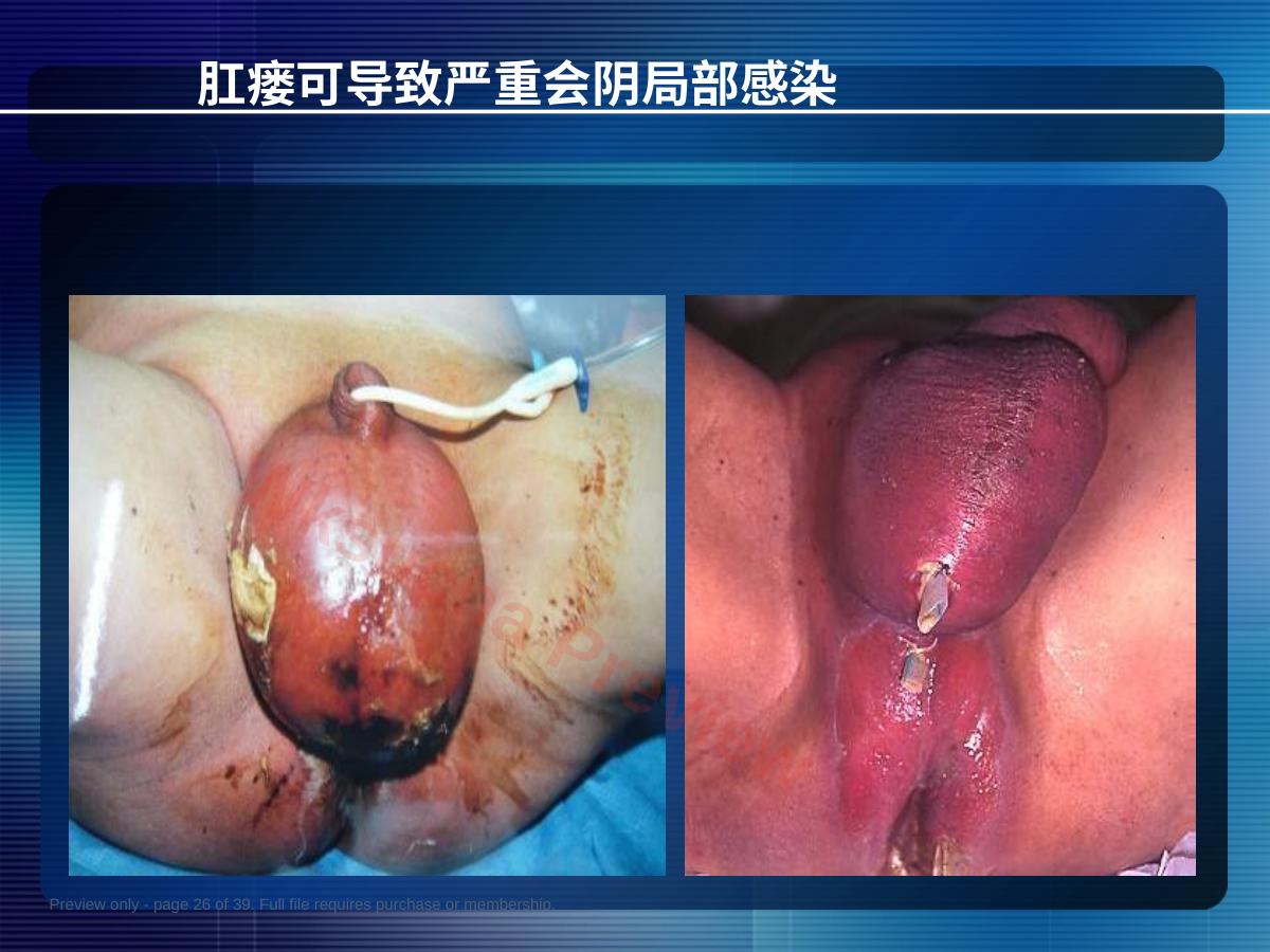 预览第 26 页