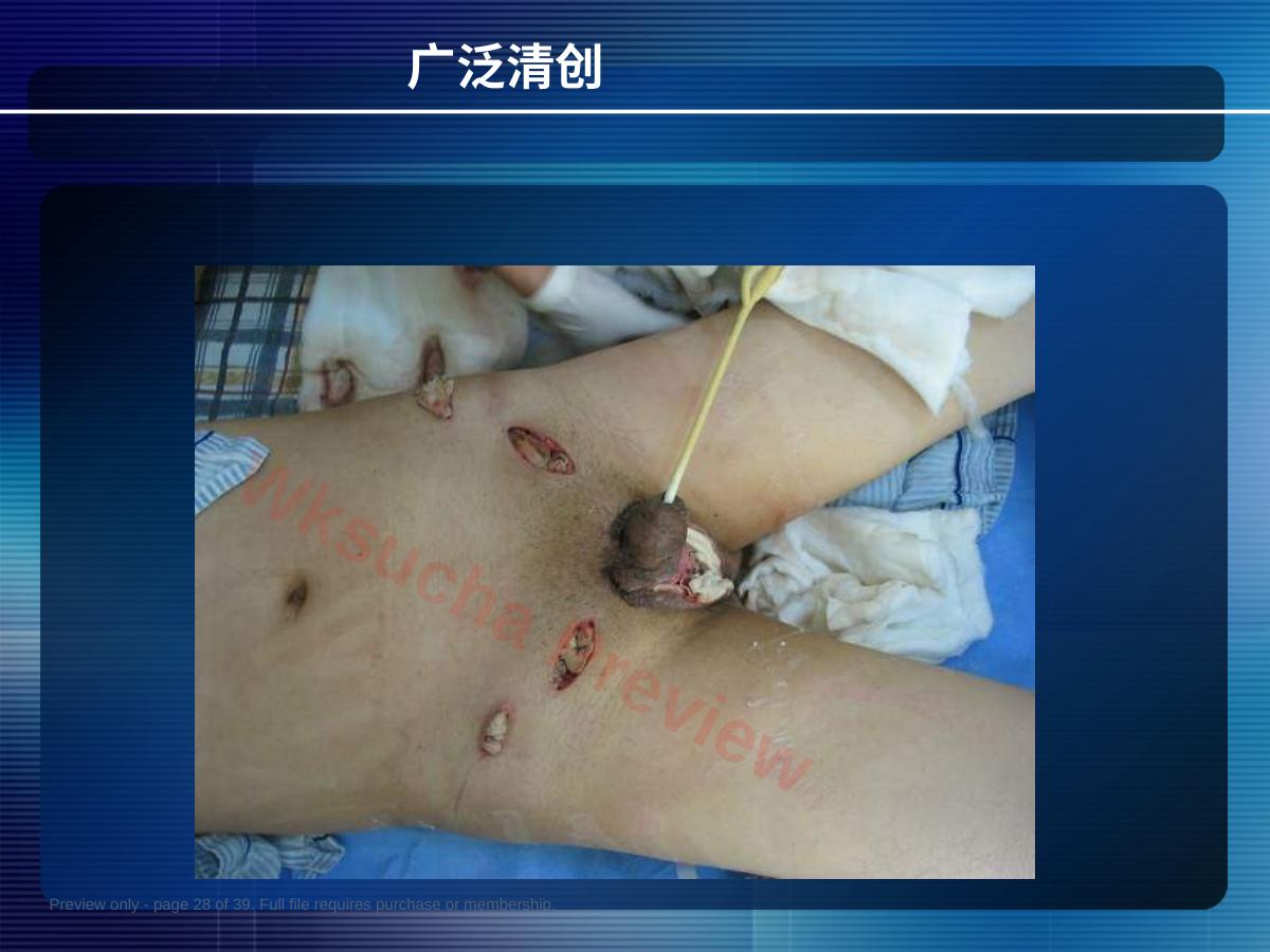 预览第 28 页