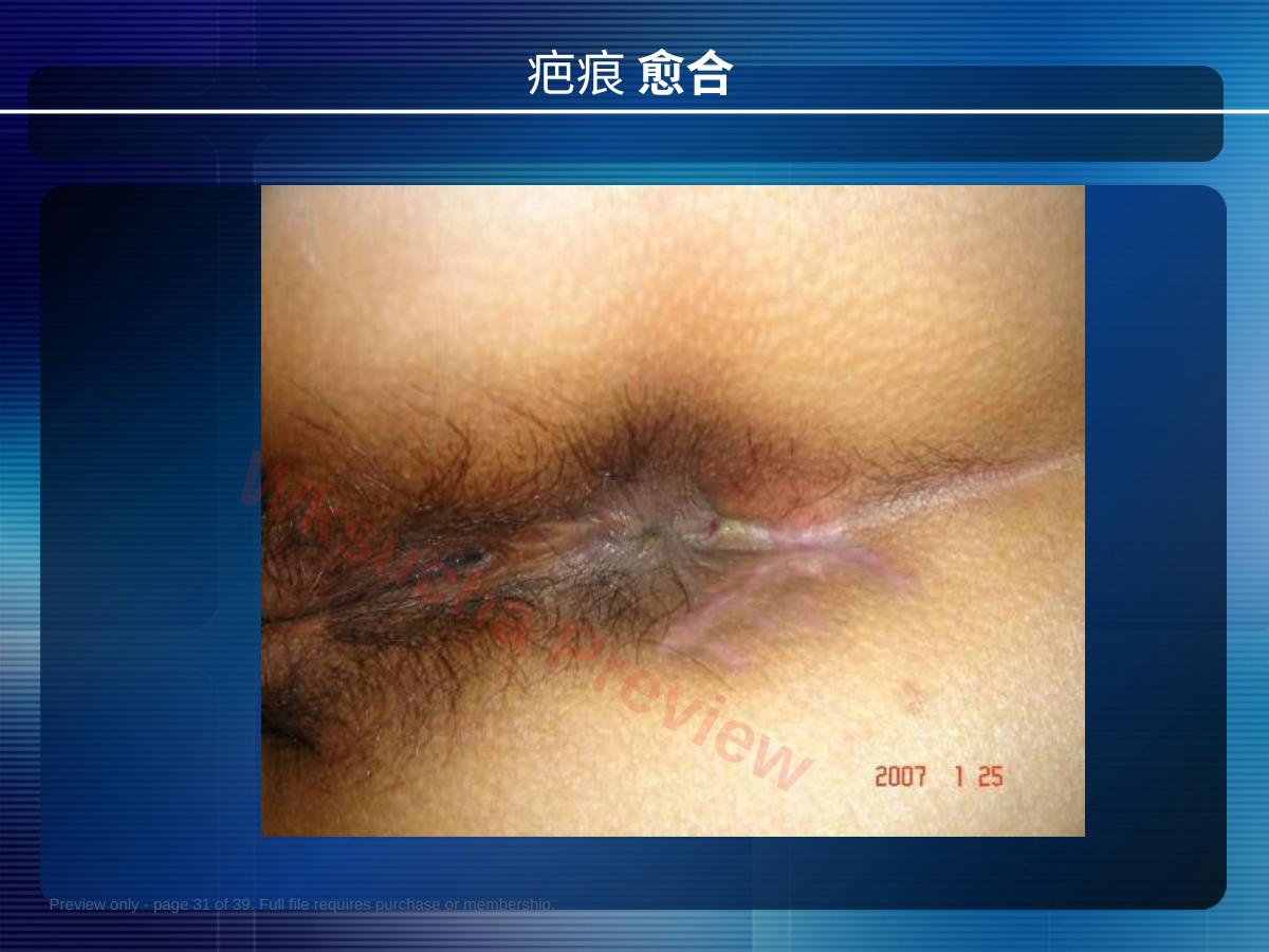 预览第 31 页
