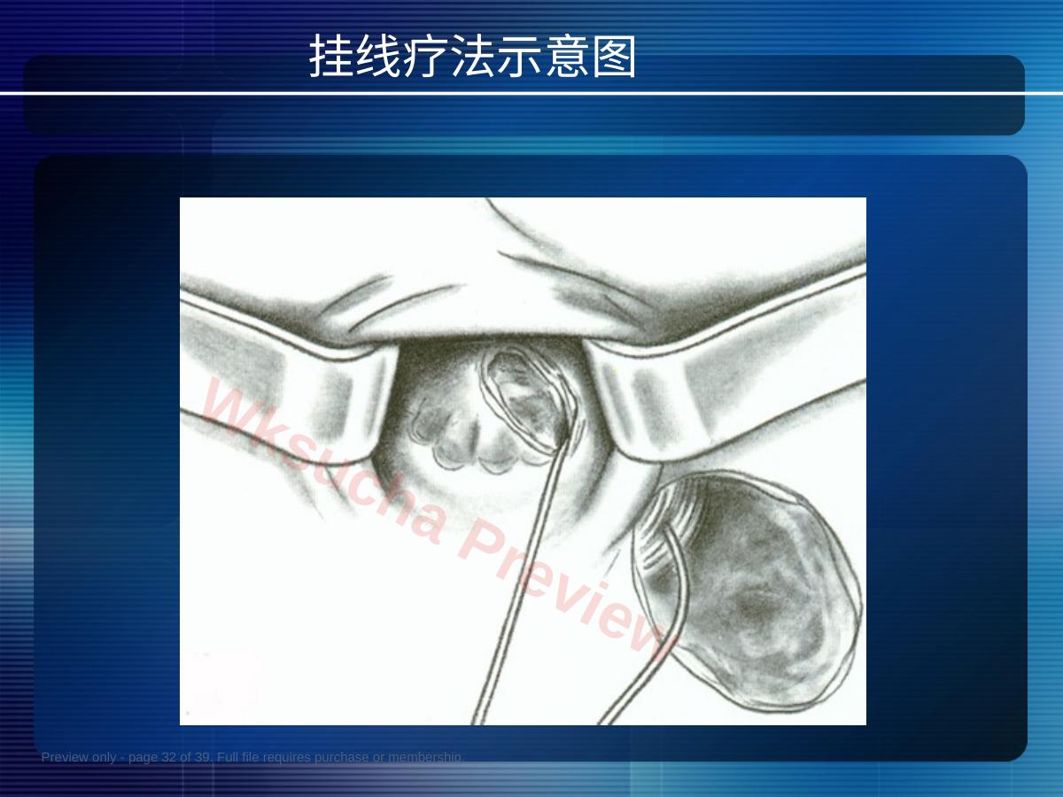 预览第 32 页