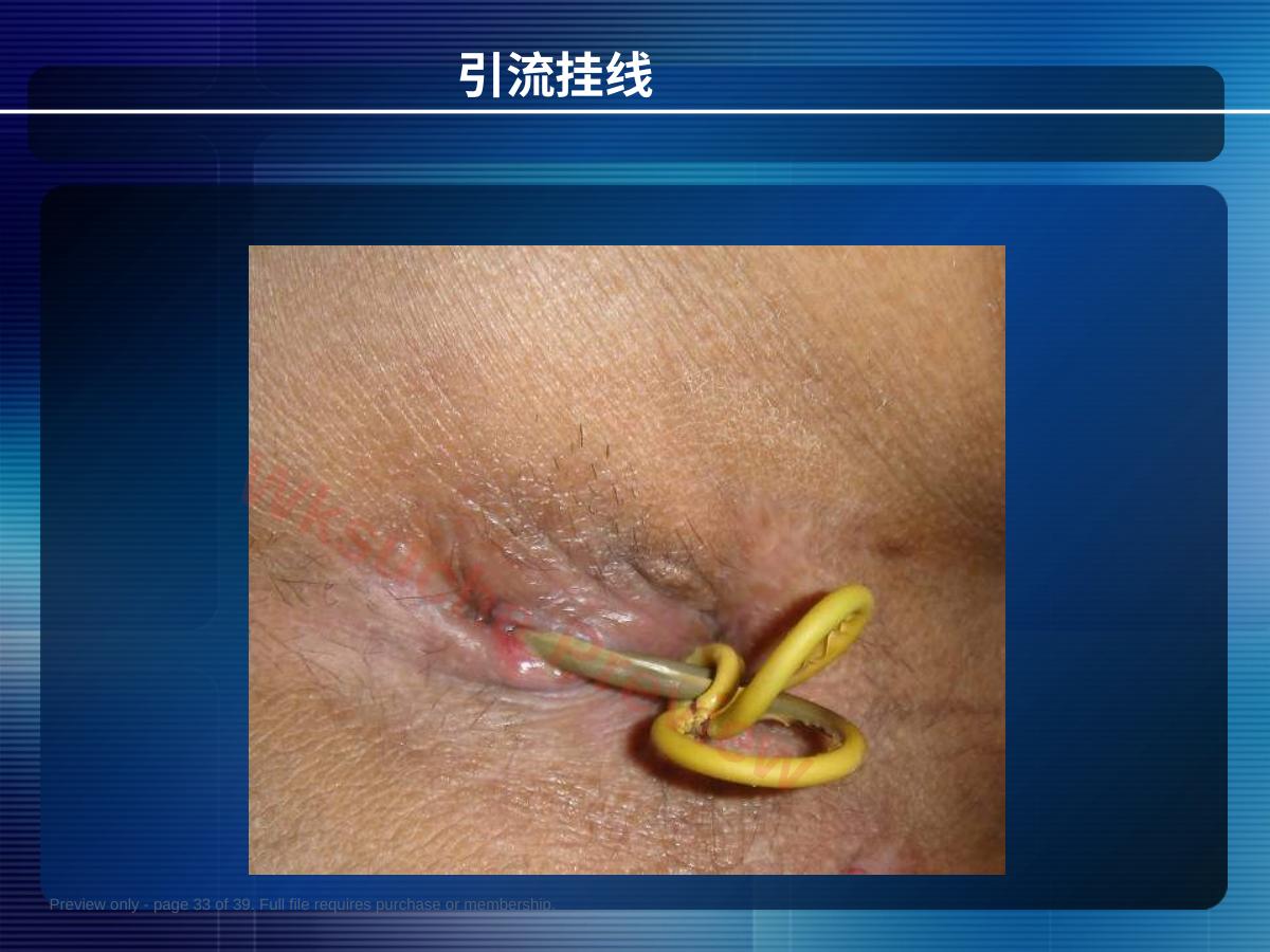 预览第 33 页