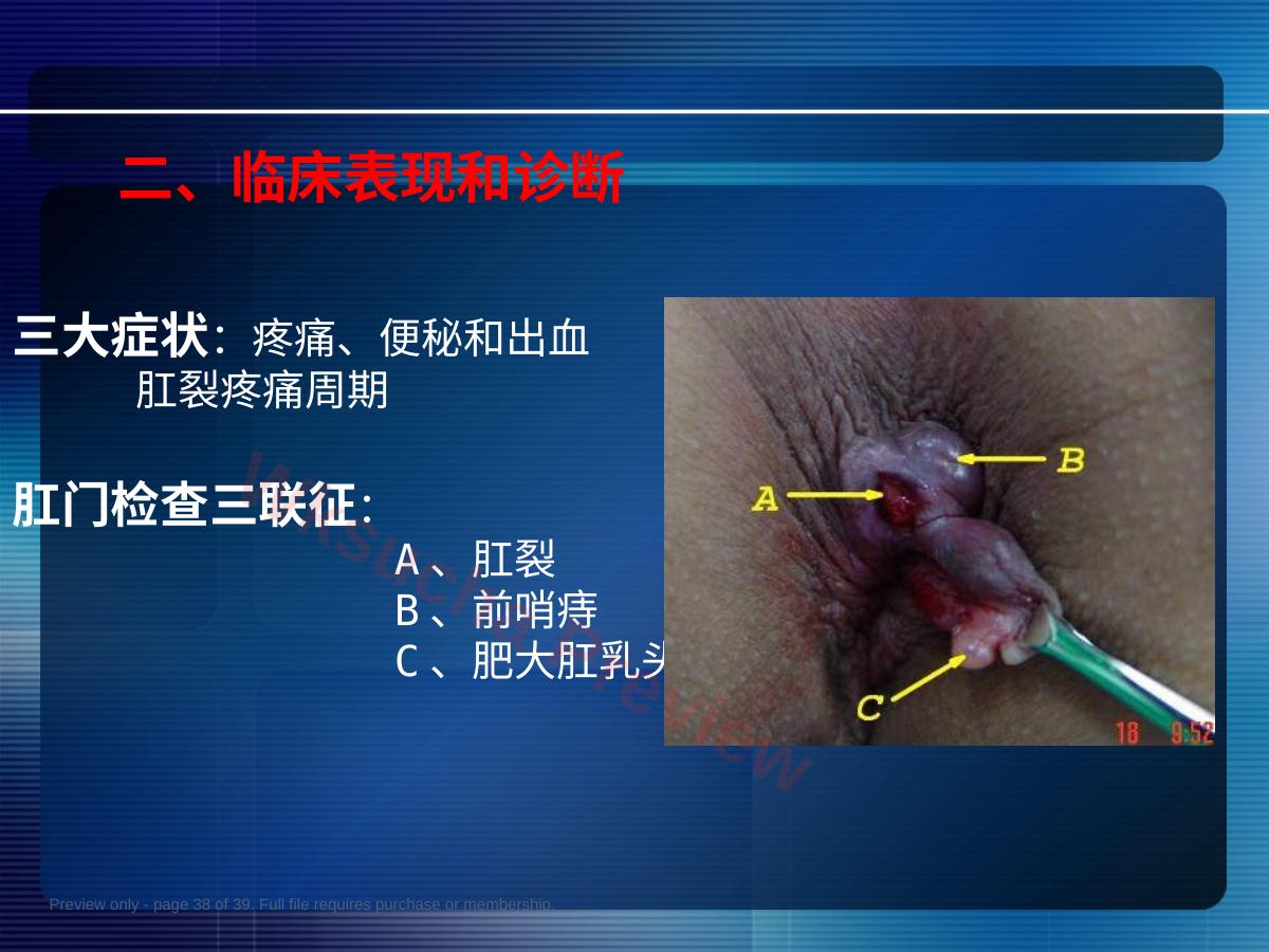 预览第 38 页