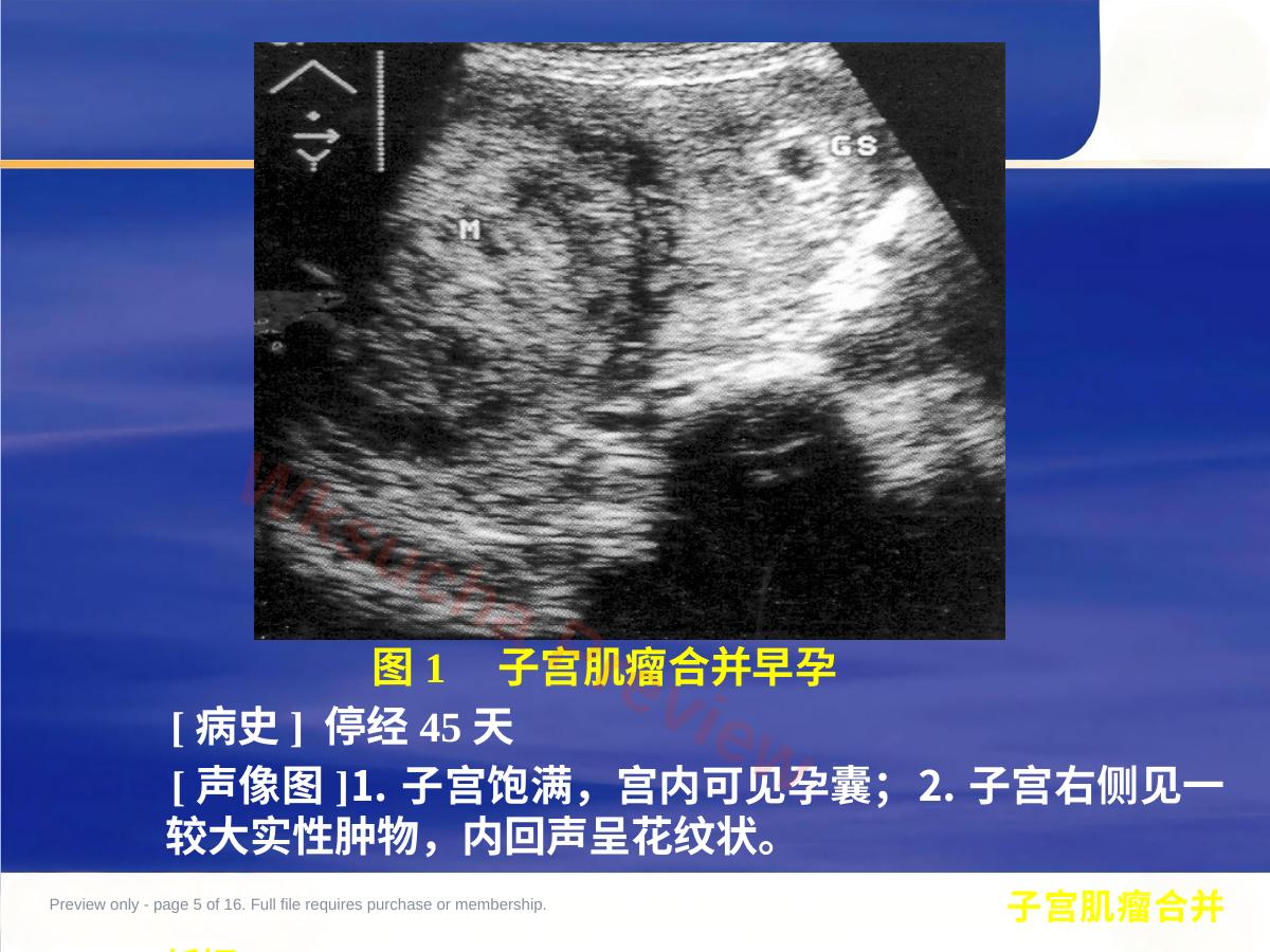 预览第 5 页