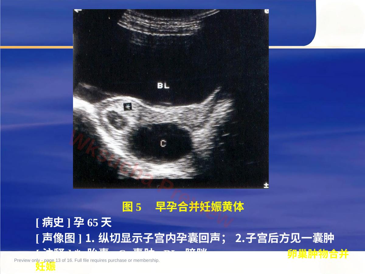 预览第 13 页