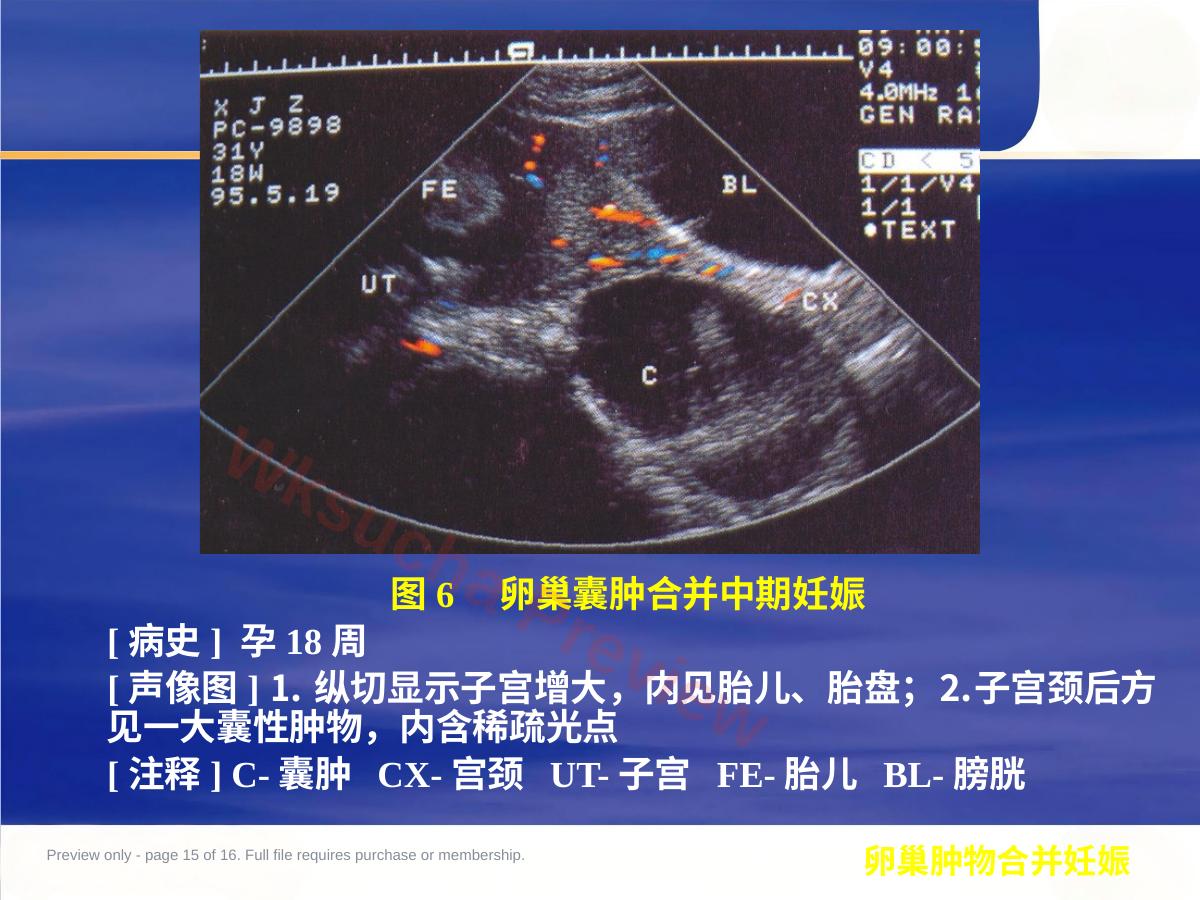 预览第 15 页