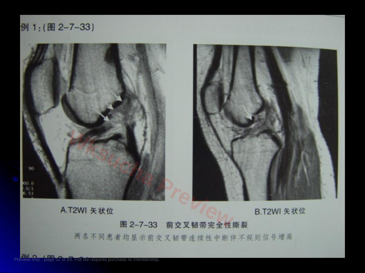 预览第 52 页