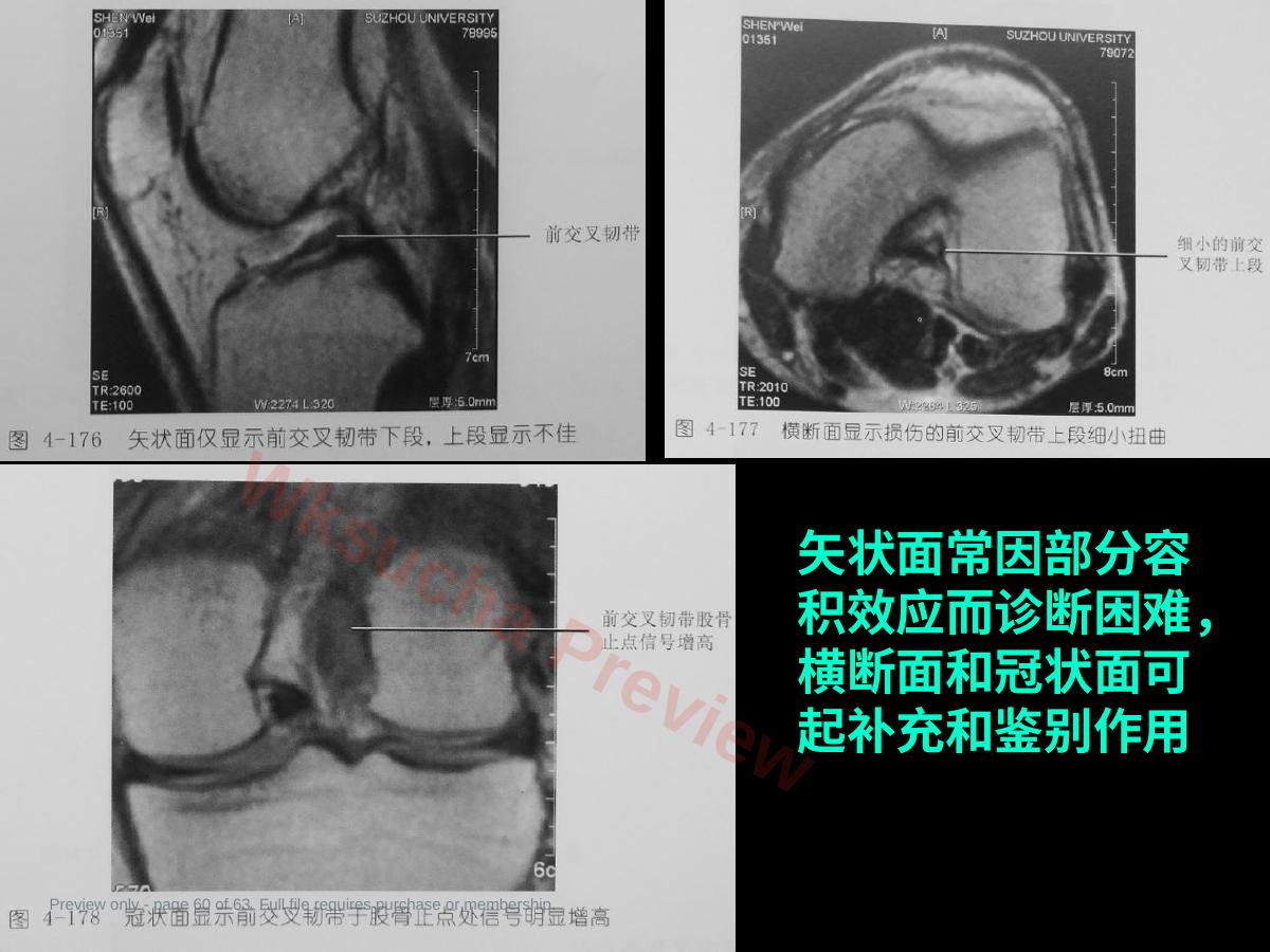预览第 60 页
