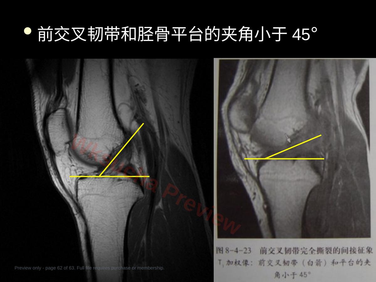 预览第 62 页
