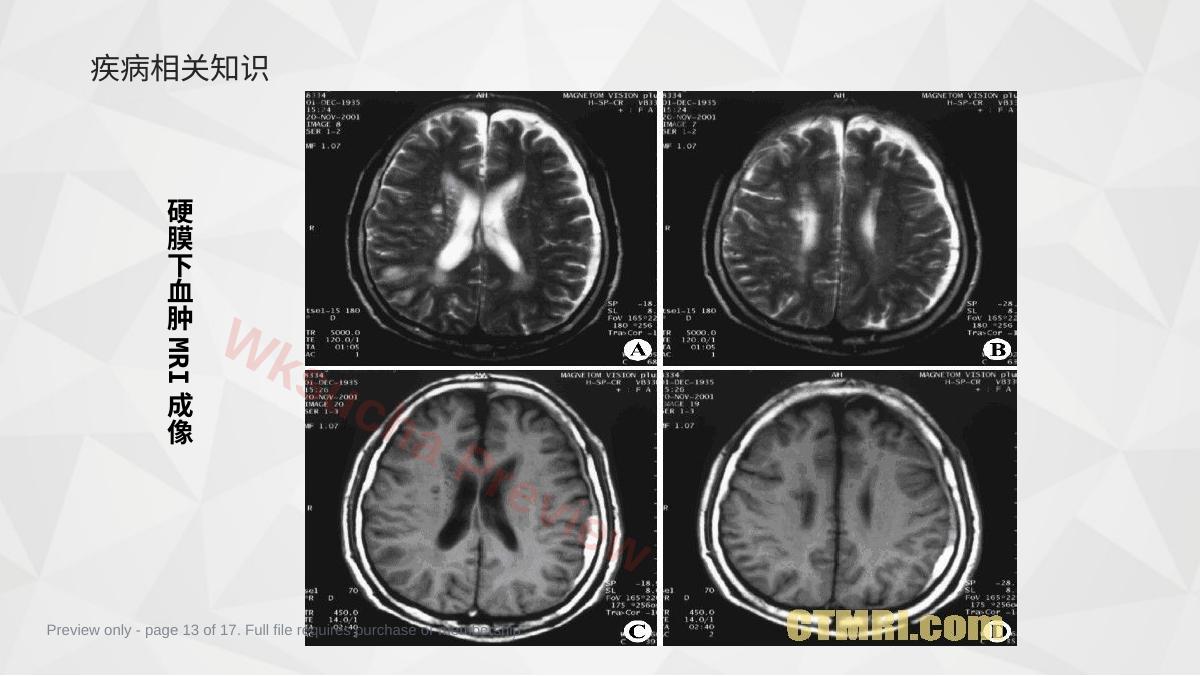 预览第 13 页