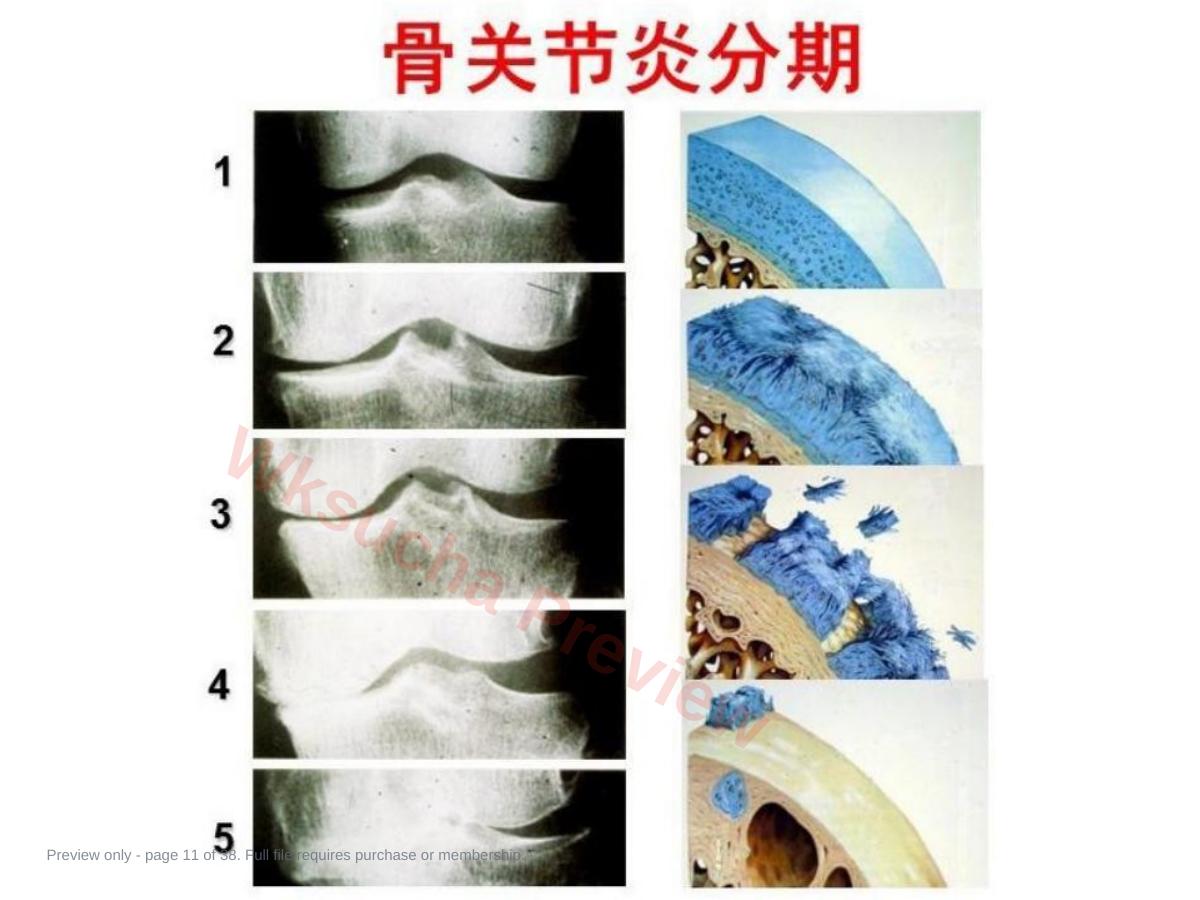 预览第 11 页