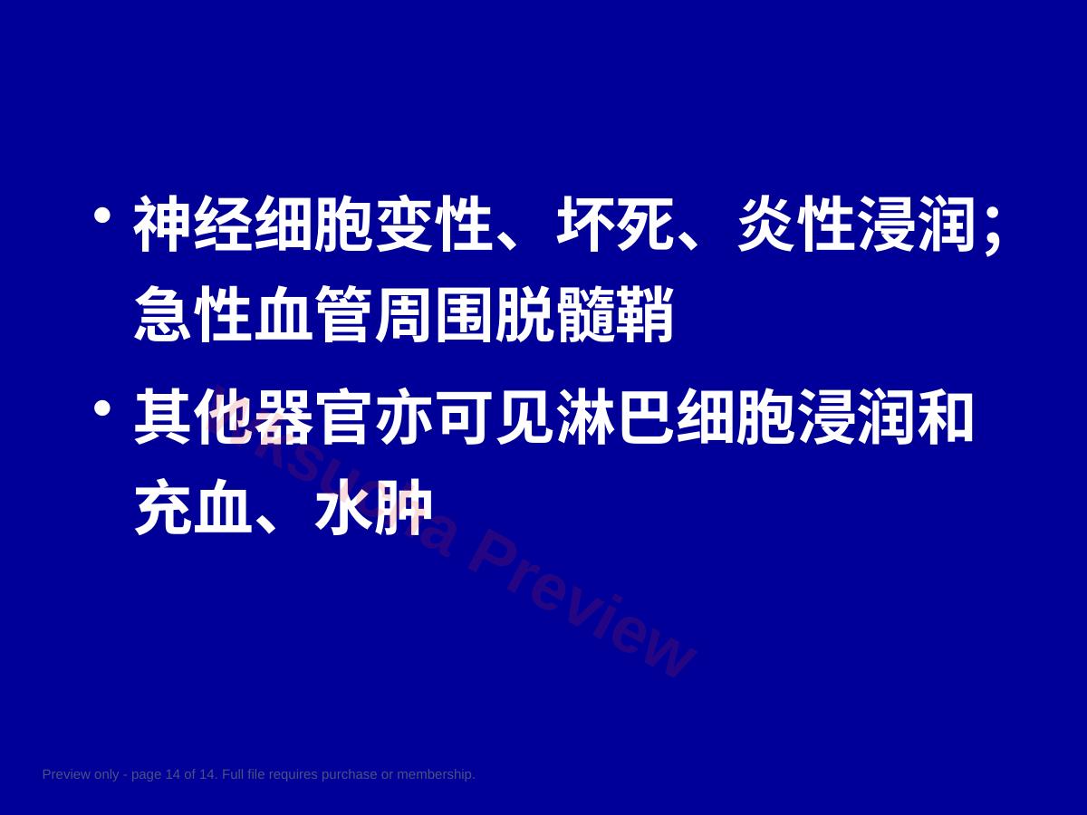 预览第 14 页