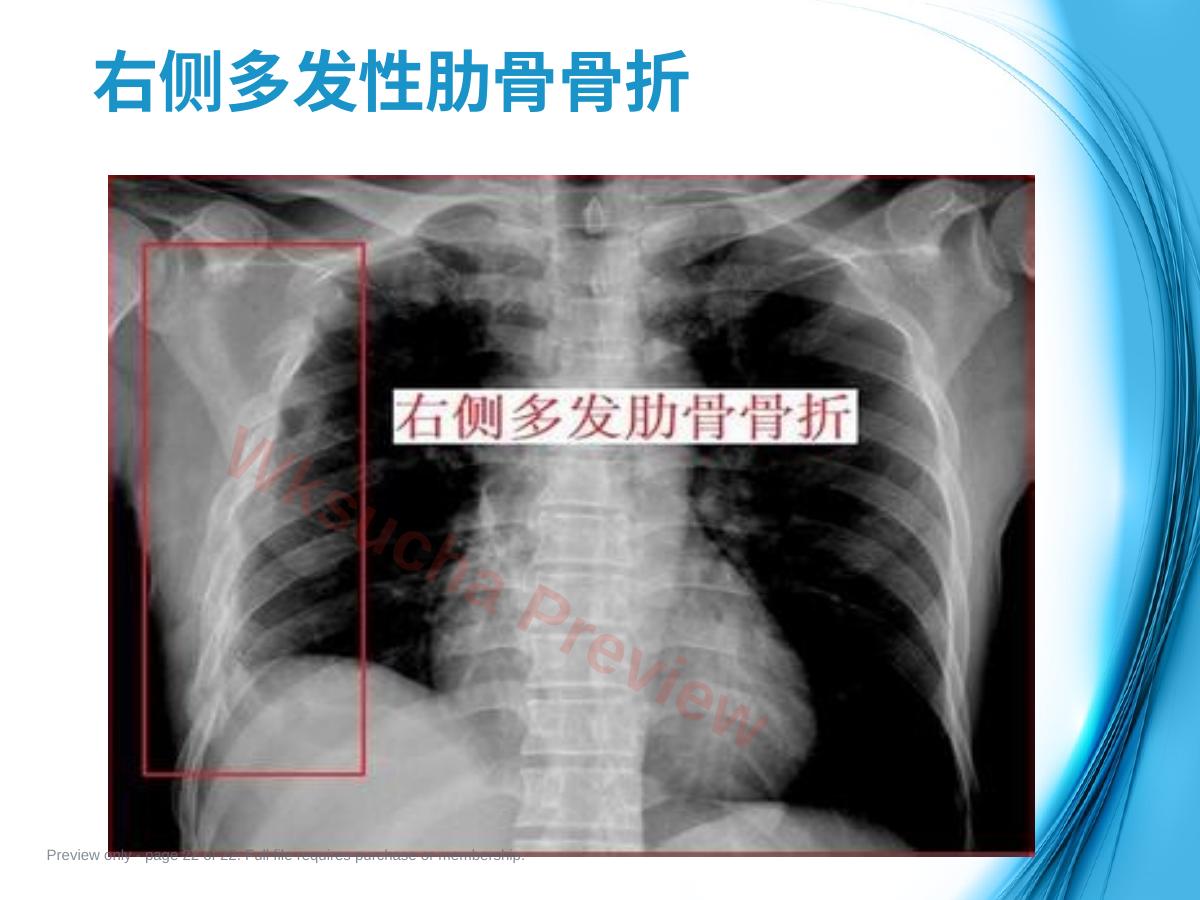 预览第 22 页
