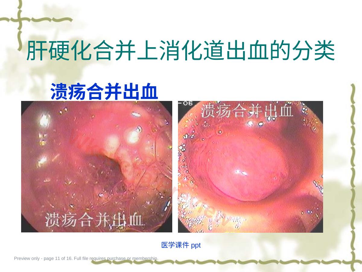 预览第 11 页