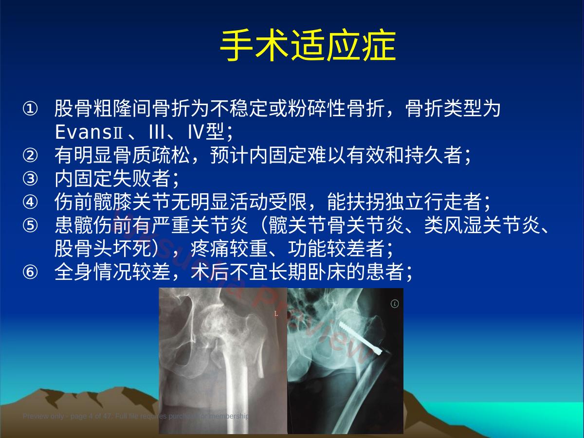 预览第 4 页