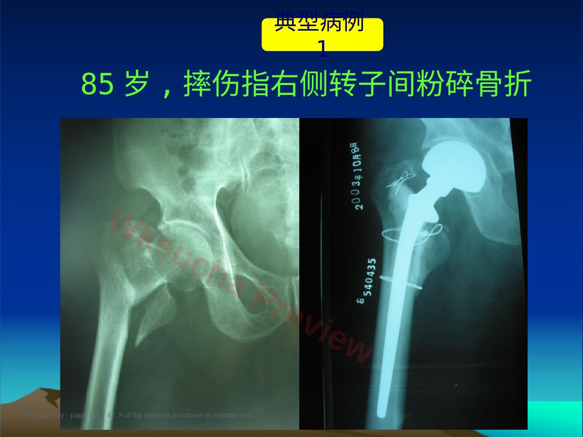 预览第 11 页