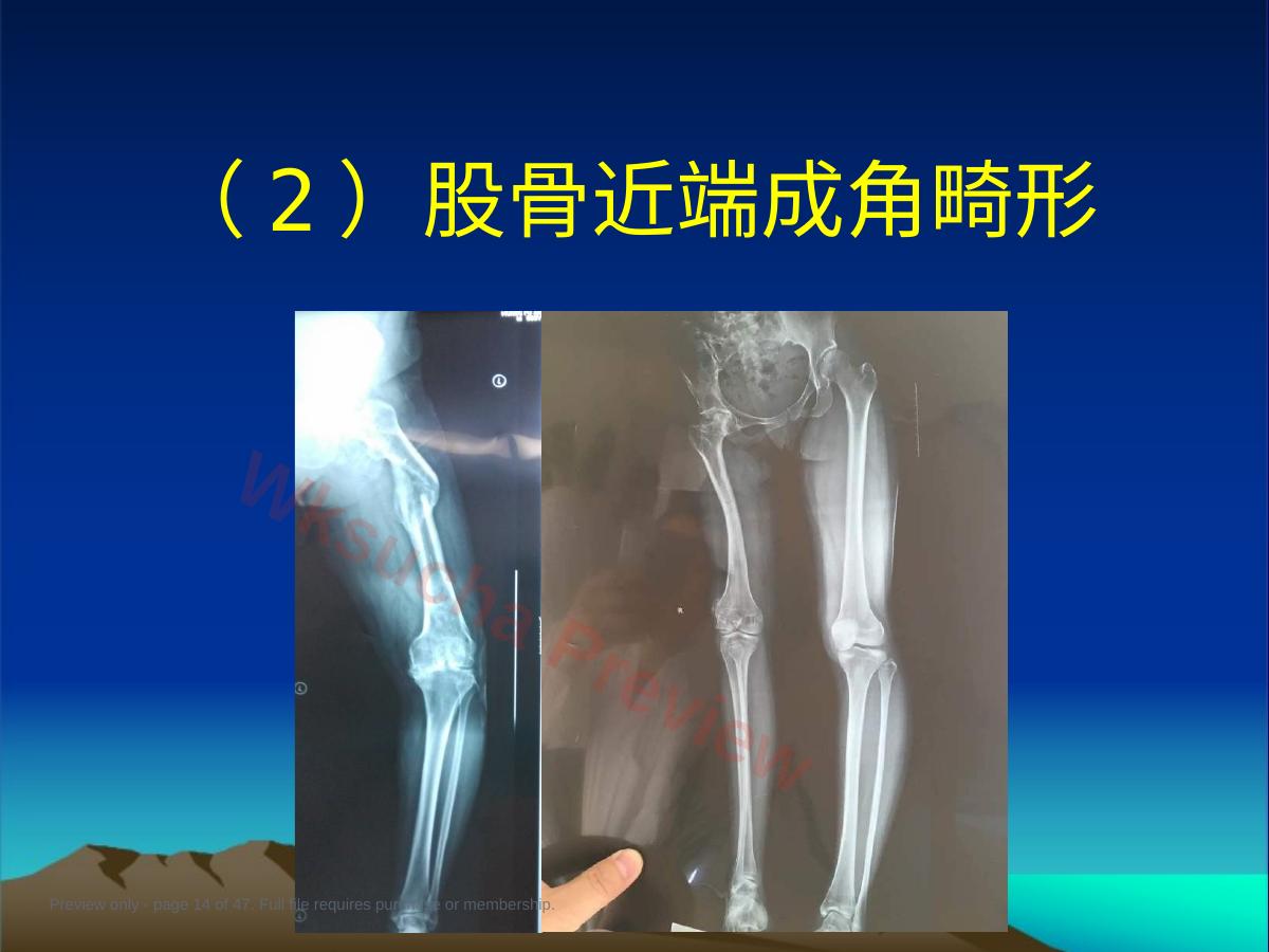 预览第 14 页