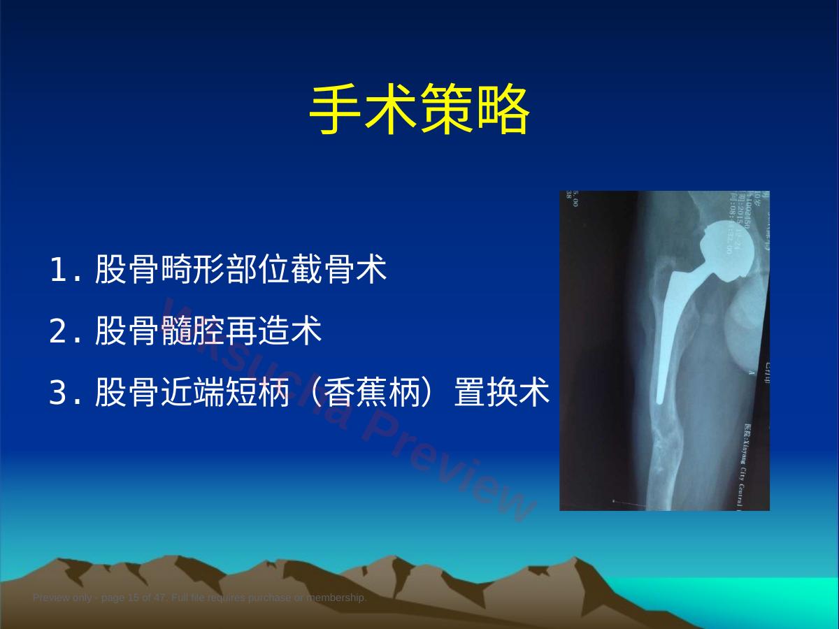 预览第 15 页